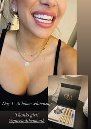 24k Hollywood whitening kit!